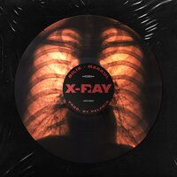 X-Ray - БИЛИК & Markul