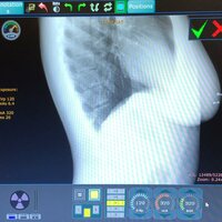 City Of The Angels - Noel & DrxcoDuke